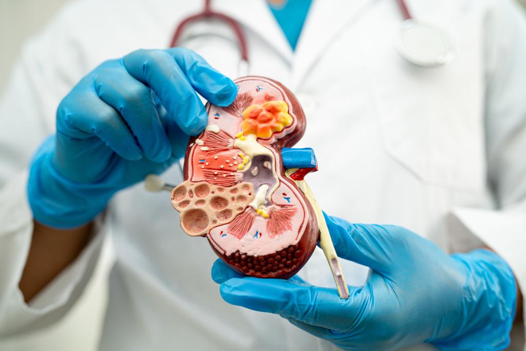 Transplantasi Ginjal