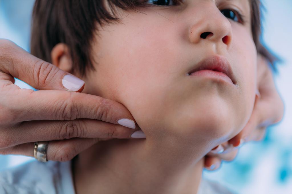 Apa itu Gondongan atau Mumps