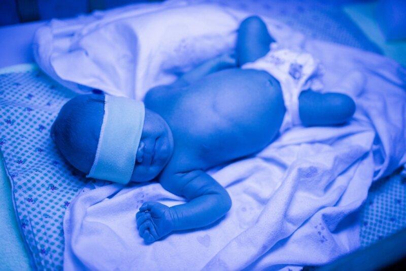 Penyebab Bayi Kuning
