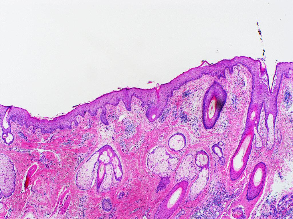 Eosinofil