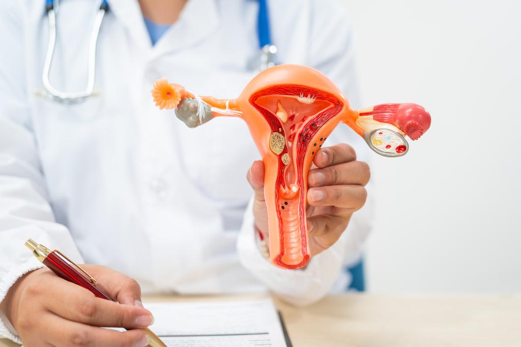 Polycystic Ovarian Syndrome